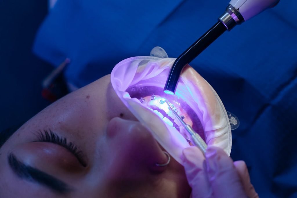 Close-up view of a dental procedure using LED curing light, enhancing oral health care.